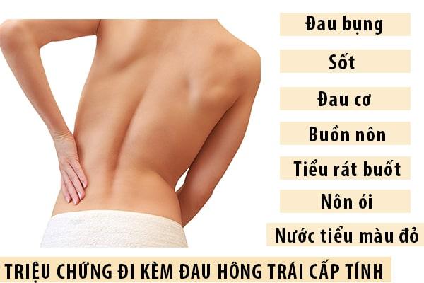 Các triệu chứng có thể đi kèm đau hông trái cấp tính Các triệu chứng có thể đi kèm đau hông trái cấp tính