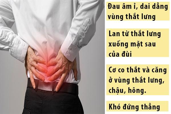 Biểu hiện của tình trạng đau thắt lưng Biểu hiện của tình trạng đau thắt lưng