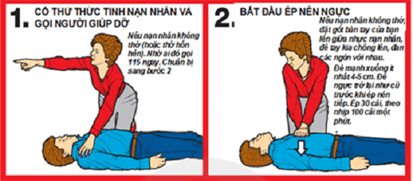 Bước 1, 2 của phương pháp CPR Bước 1, 2 của phương pháp CPR