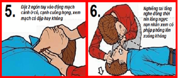 Bước 5, 6 của phương pháp CPR Bước 5, 6 của phương pháp CPR