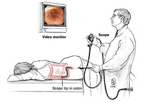 điều trị bệnh trĩ