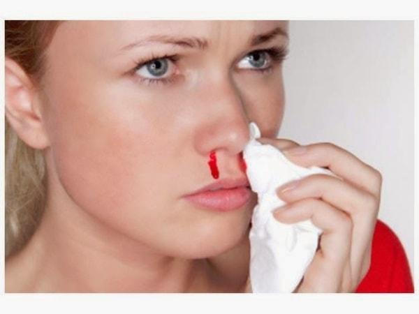 Triệu chứng chảy máu mũi Triệu chứng chảy máu mũi