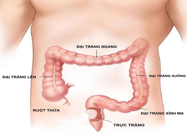 Triệu chứng chảy máu trực tràng Triệu chứng chảy máu trực tràng