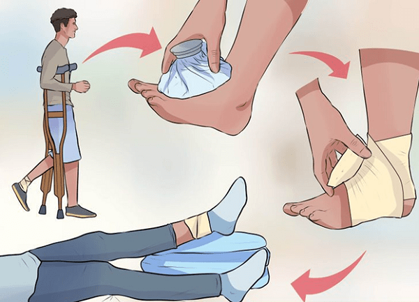 Biện pháp chăm sóc khi bị đau cổ chân Biện pháp chăm sóc khi bị đau cổ chân