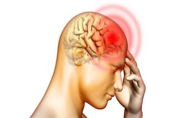Triệu chứng bệnh u màng não
