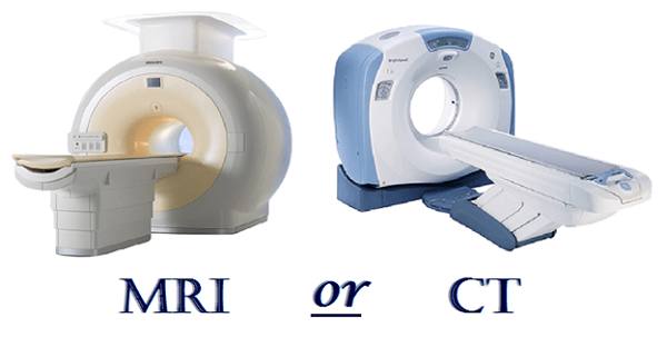 Chẩn đoán dị dạng mạch máu não bằng phương pháp MRI