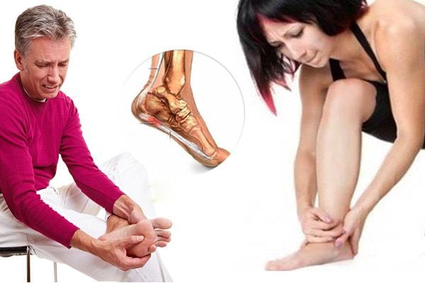 Những biến chứng của bệnh giãn tĩnh mạch Những biến chứng của bệnh giãn tĩnh mạch