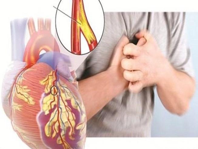Mất ngủ là nguy cơ của bệnh tim mạch, tăng huyết áp Mất ngủ là nguy cơ của bệnh tim mạch, tăng huyết áp