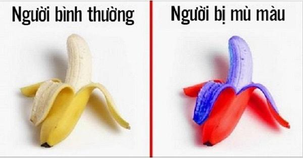 Dấu hiệu và triệu chứng của bệnh mù màu Dấu hiệu và triệu chứng của bệnh mù màu