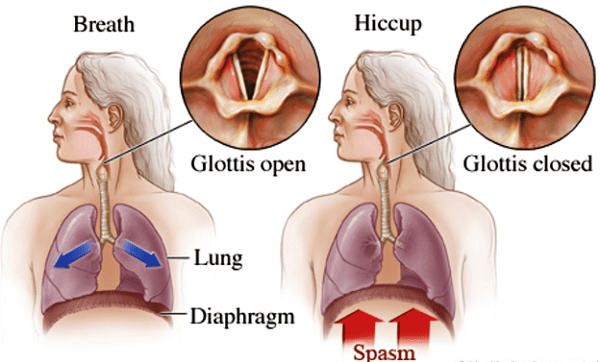 Nguyên nhân gây ra nấc cục Nguyên nhân gây ra nấc cục