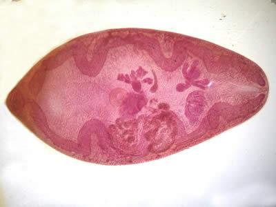 nhiễm sán