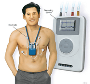 Holter ECG Holter ECG