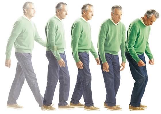 Triệu chứng của bệnh Parkinson Triệu chứng của bệnh Parkinson