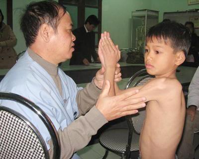 Phẫu thuật teo cơ Delta Phẫu thuật teo cơ Delta
