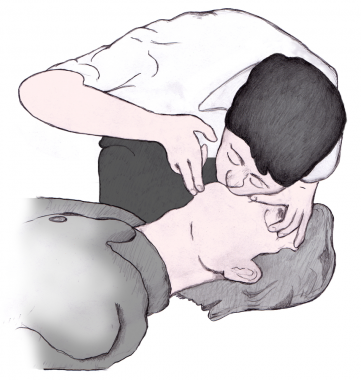 Sơ cứu tai biến mạch máu não Sơ cứu tai biến mạch máu não