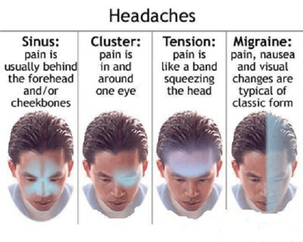 Nguyên nhân gây ra đau đầu kiểu căng thẳng thần kinh Nguyên nhân gây ra đau đầu kiểu căng thẳng thần kinh