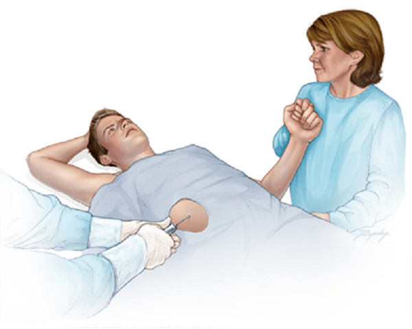 Điều trị ung thư biểu mô tế bào gan