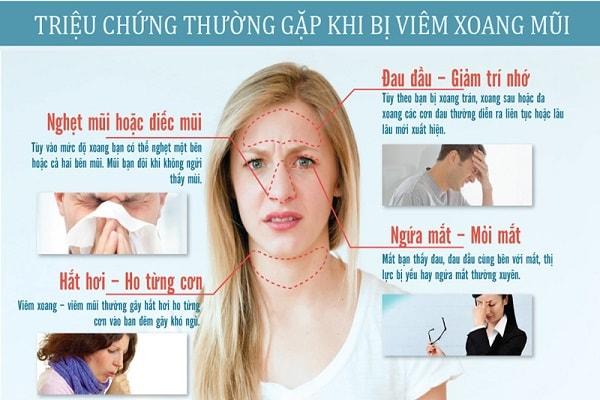 Triệu chứng của bệnh viêm xoang Triệu chứng của bệnh viêm xoang